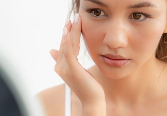 Rosacea
